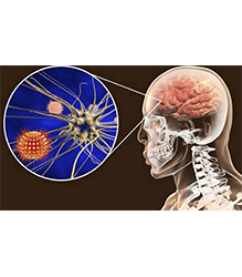 Covid-19- brain