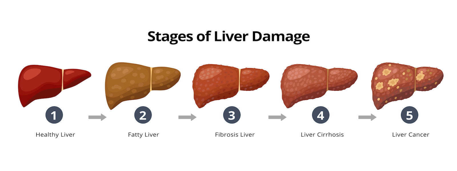 live disease